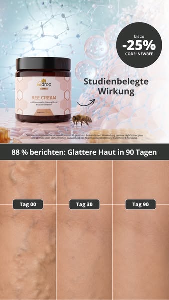 Besenreiser? Deutschlands #1 Bienengift-Creme
