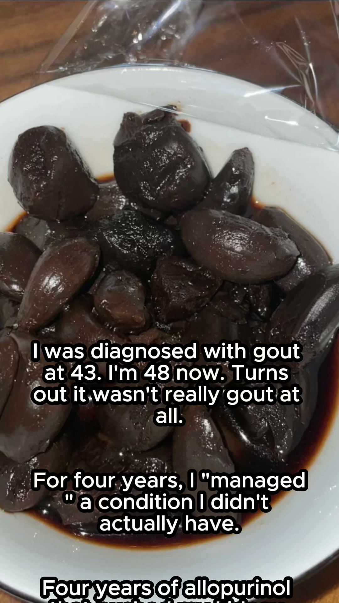 Four Years Of “Gout” Wasn’t Gout