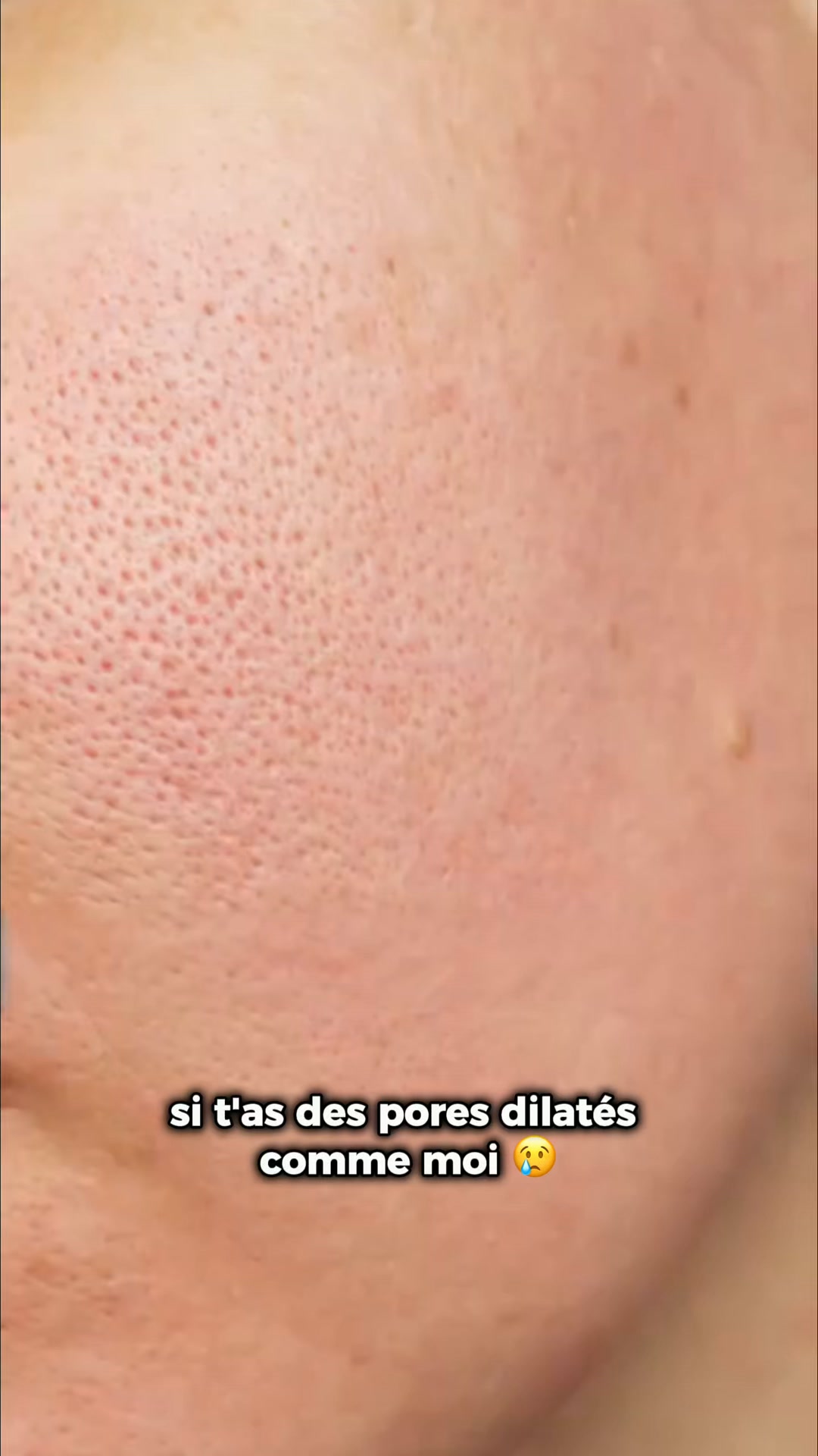 Transformez votre peau en 5 minutes !