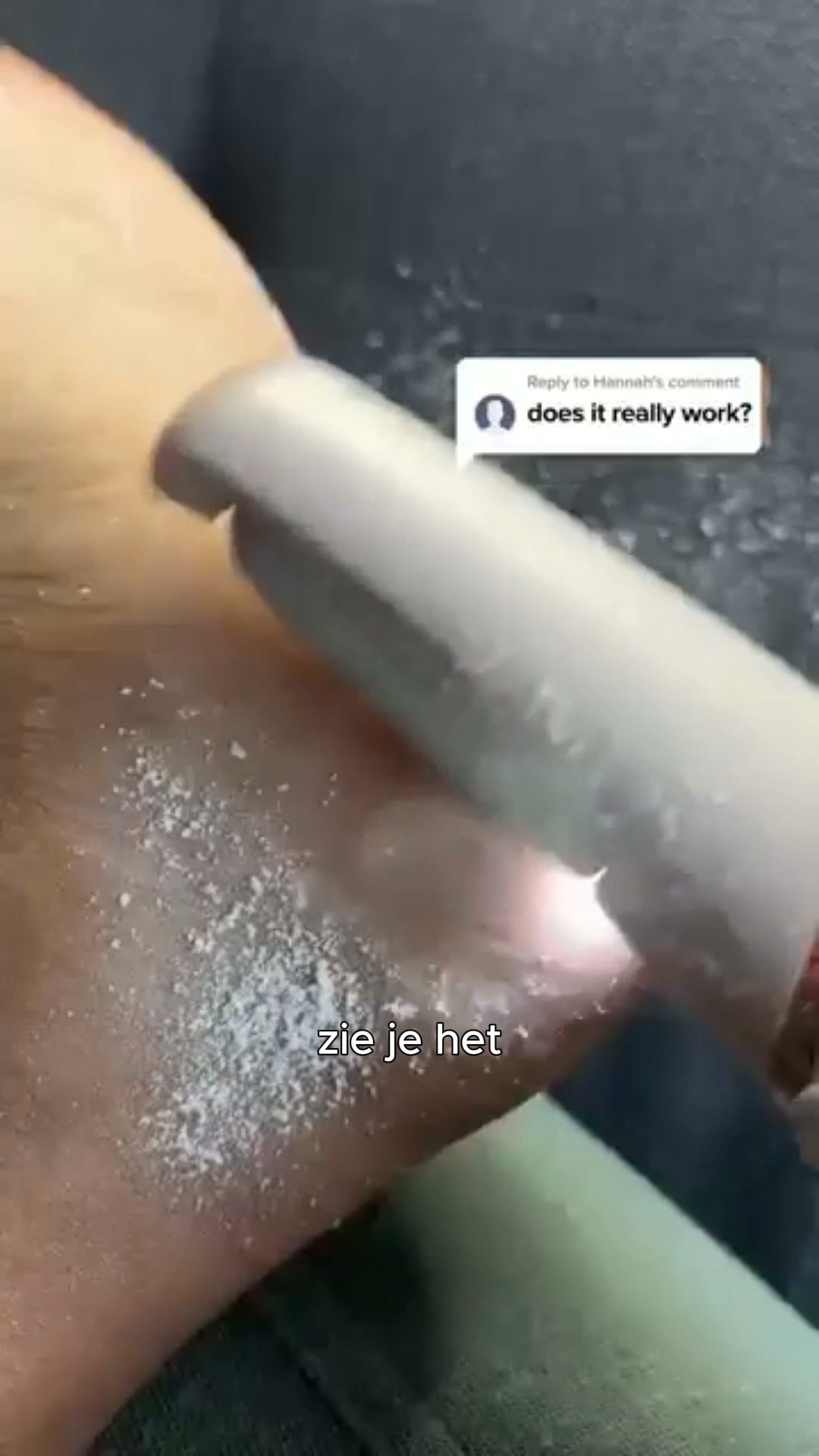 Alles geprobeerd tegen eelt?