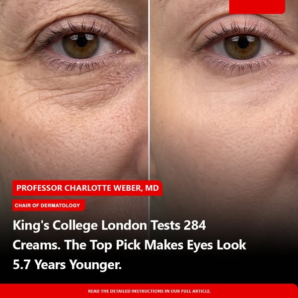 King's College London Tests 284 Creams. The Top Pick Makes Eyes Look 5.7 Years Younger.
