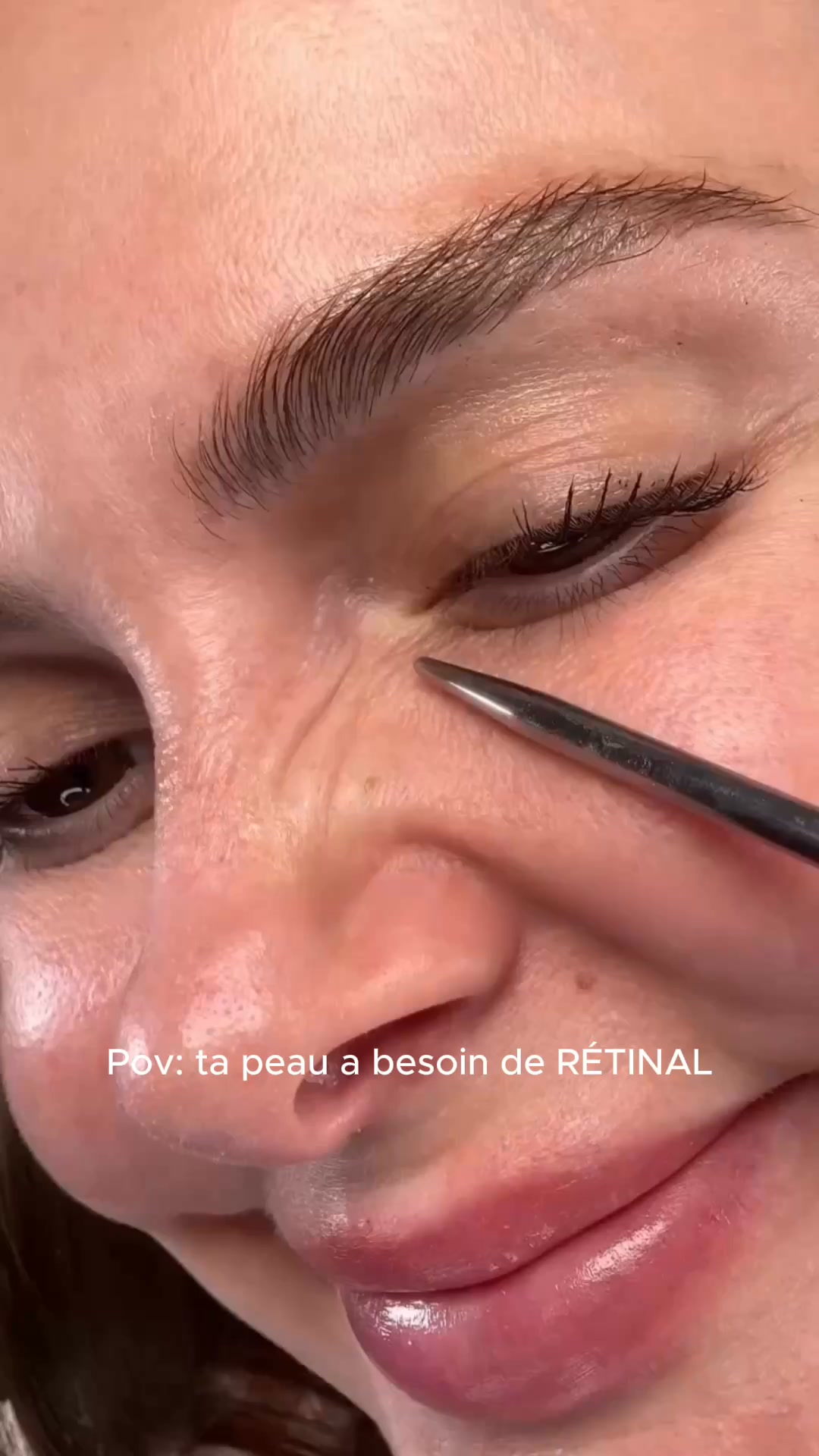 Le boost dont ma peau avait besoin