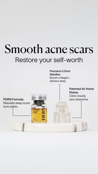 Fade Post-Acne Scars at Home