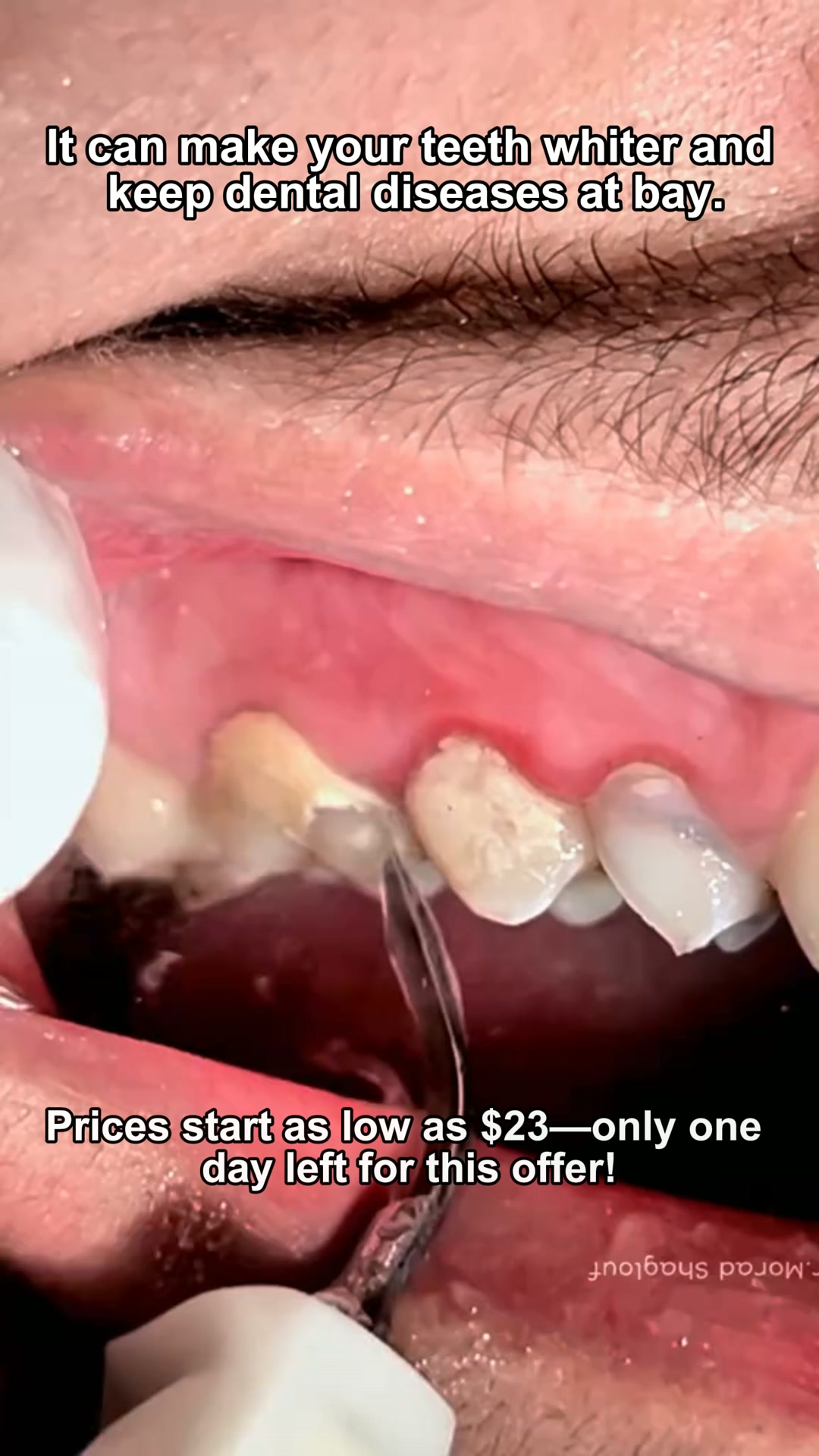 With this, you can have neater, whiter teeth—free from bad breath and tartar.