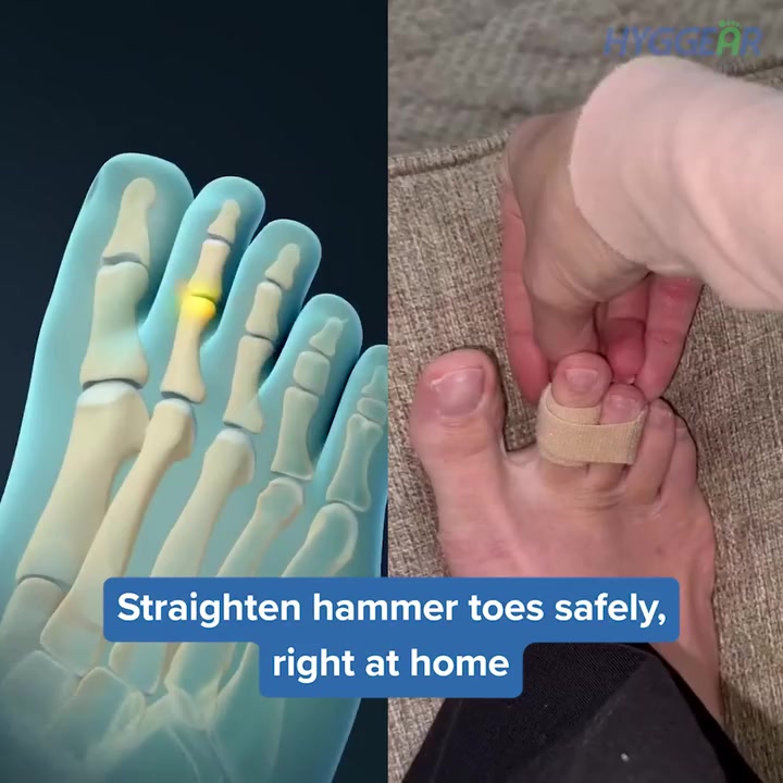 HOW TO GET RID OF FOOT NUMBNESS?