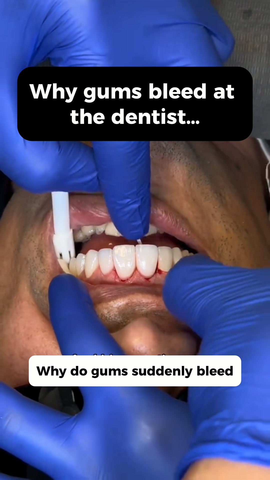 Your Dentist Knows You Skipped This