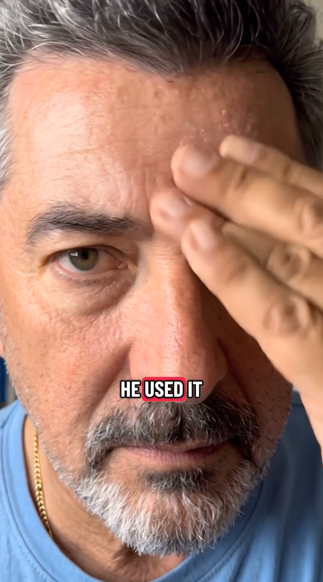 Real Results for Wrinkles