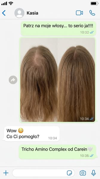 Coraz więcej włosów na szczotce?