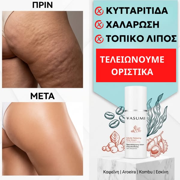 Κυτταρίτιδα & Χαλάρωση ΤΕΛΟΣ!!