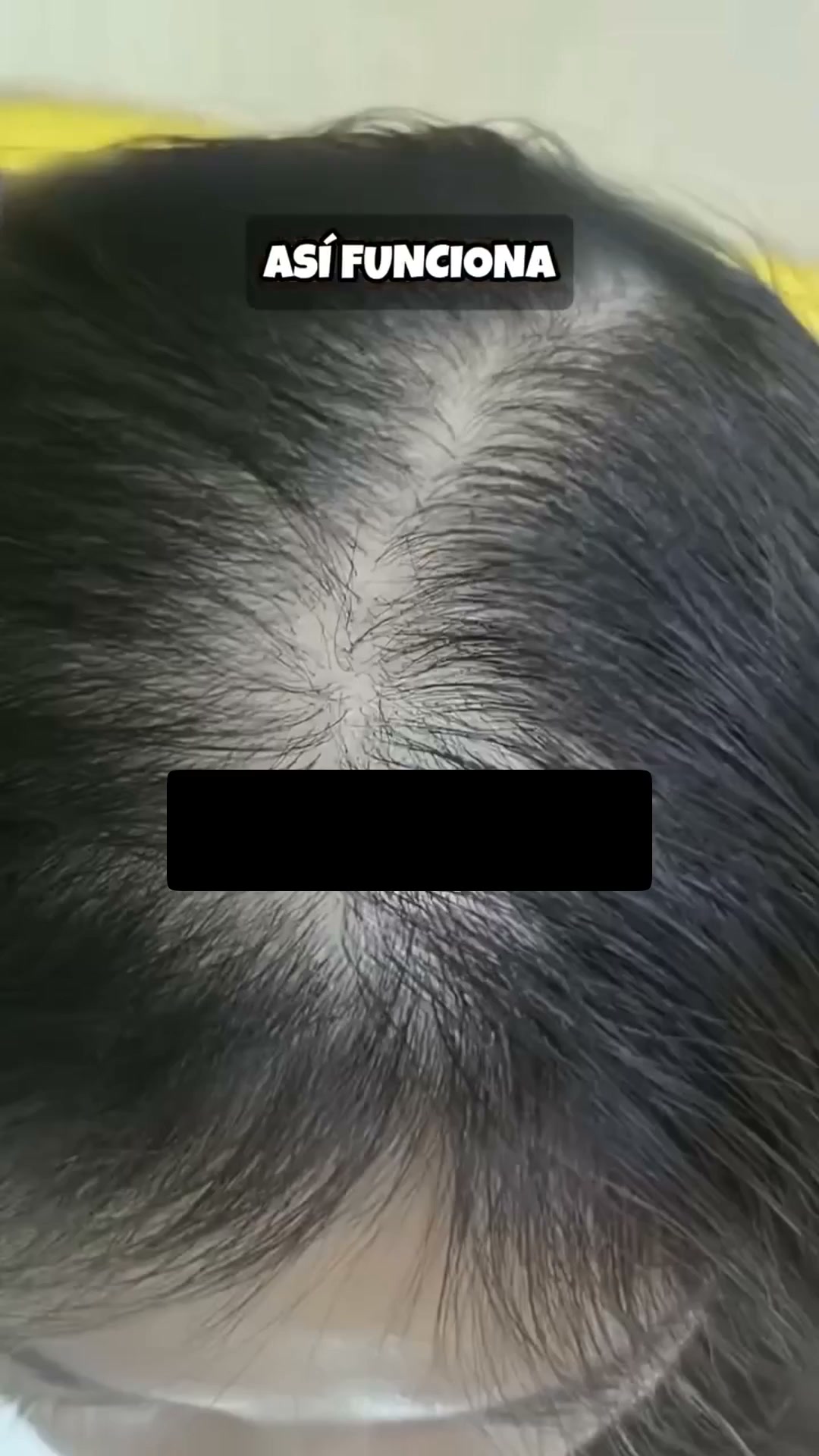 Cabello Más Abundante y Fuerte