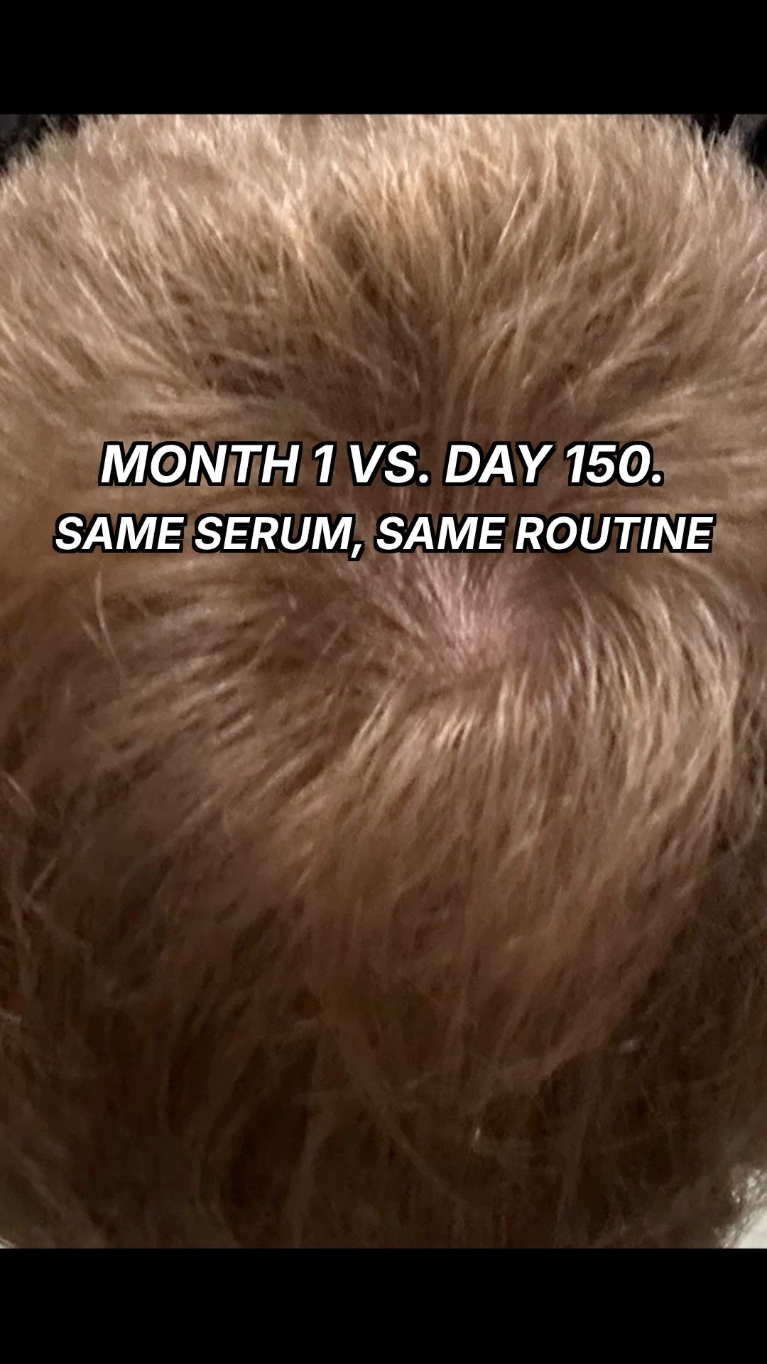 150-day money-back guarantee