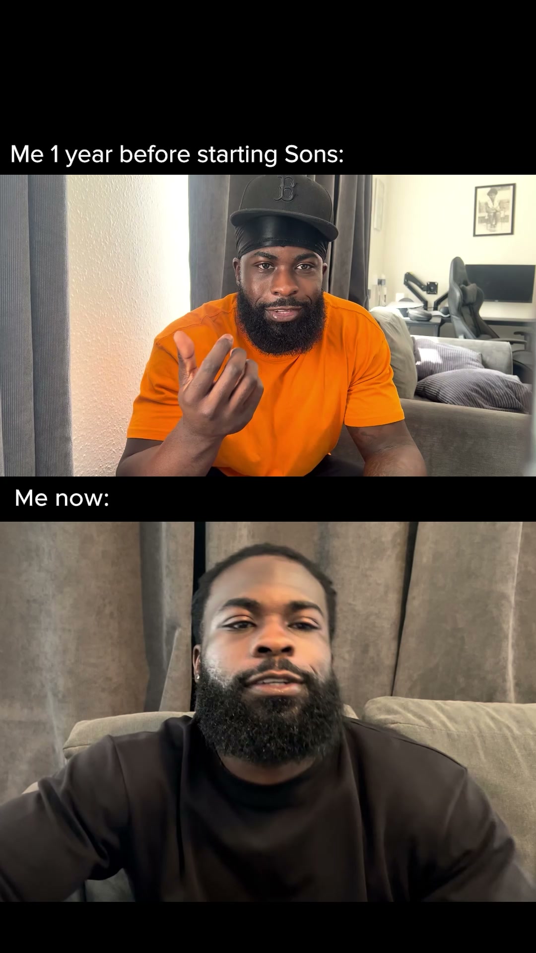 Your hairline. Your call.