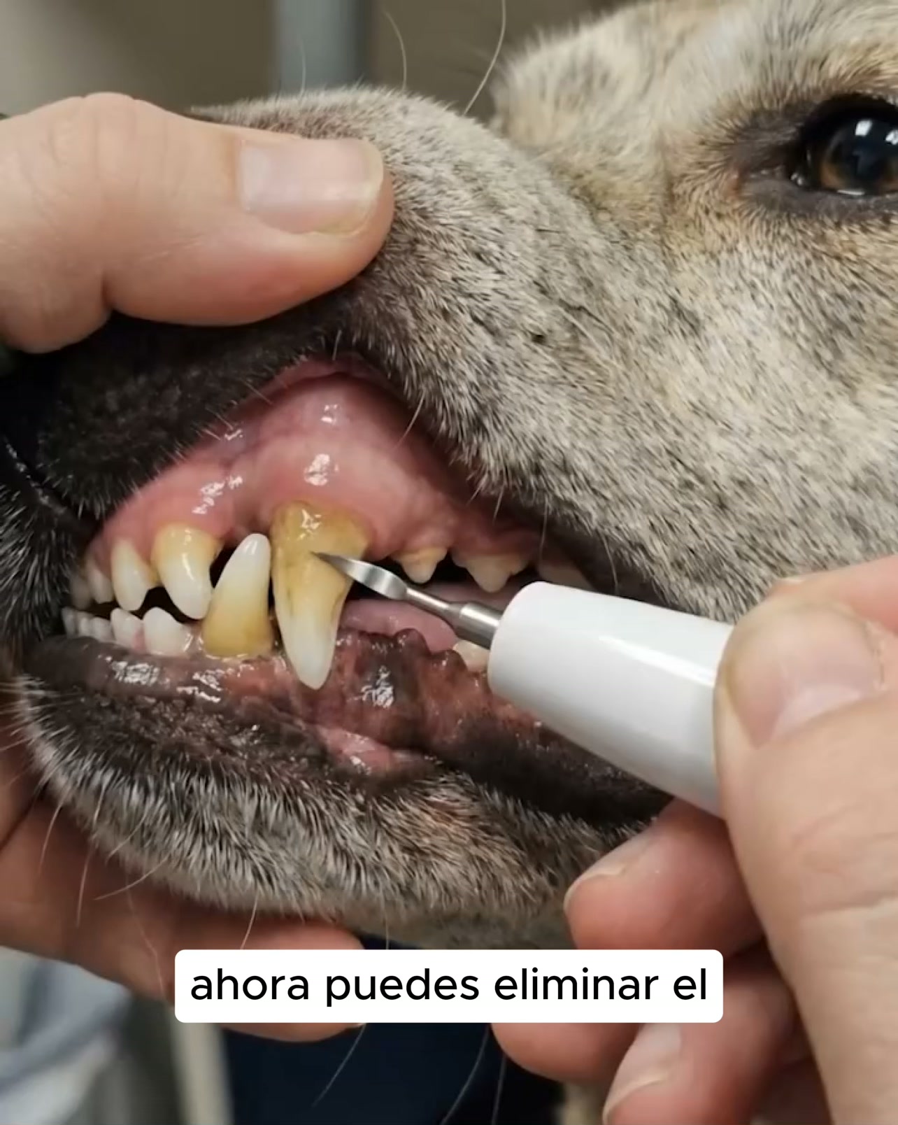Kit Goldoris - Eliminador ultrasónico silencioso de placa y sarro para perros