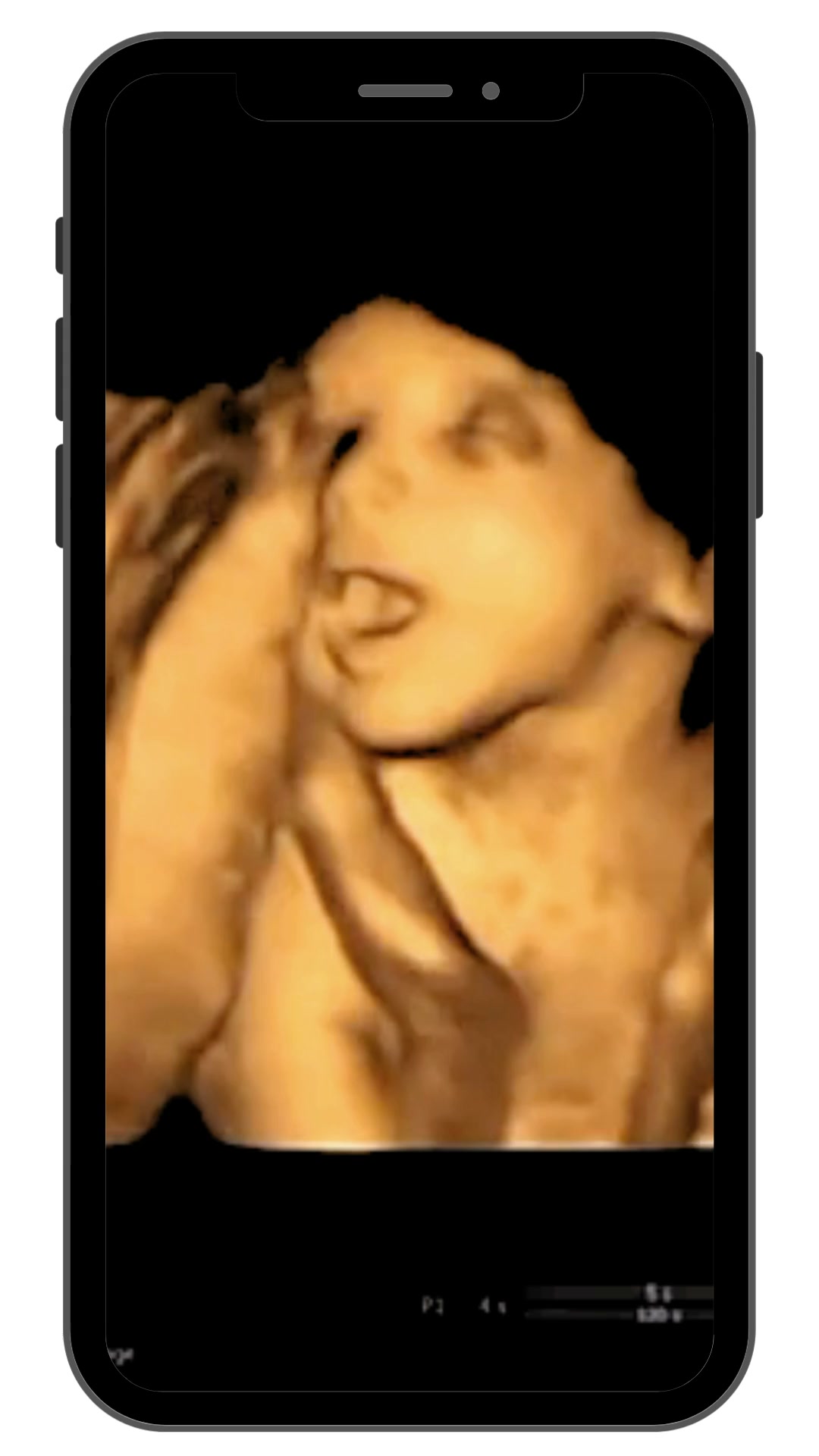 4D Scan from 24 weeks+