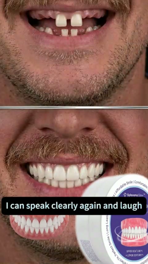 Smile with confidence in 3 minutes