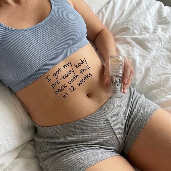 Stretch Marks? Try This At Home