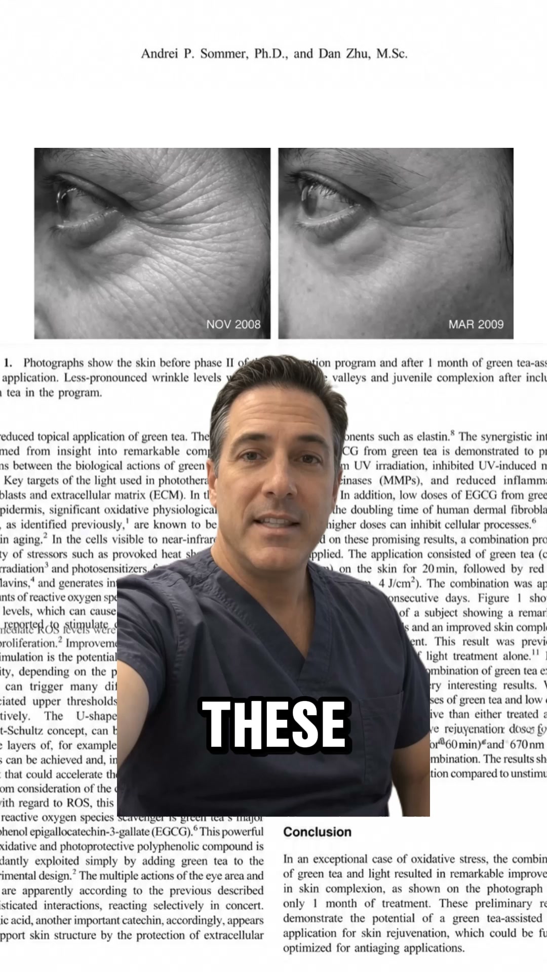 Erase eye wrinkles with science NOT botox