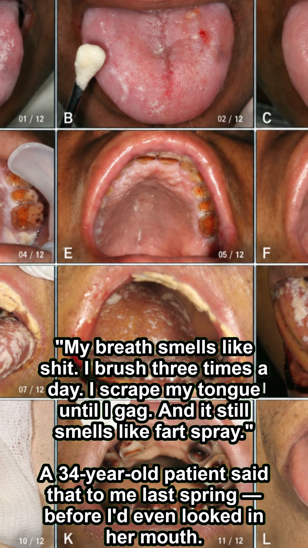 If your bad breath is constant all day, it's not coming from your mouth