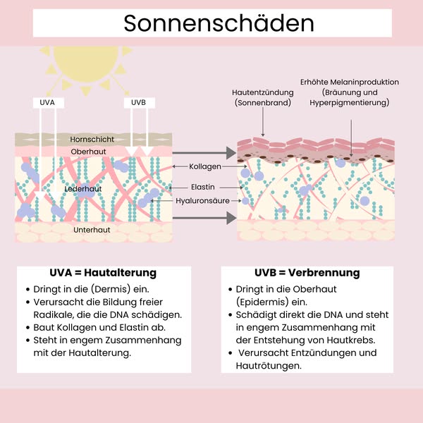 Wenn die Sonne dich zu sehr liebt