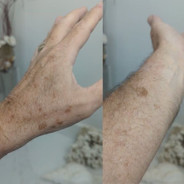 I Accepted the as Permanent. I was Wrong.