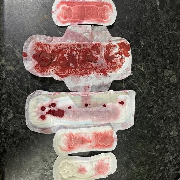 On Thyroid Meds But The Bleeding Won't Stop?