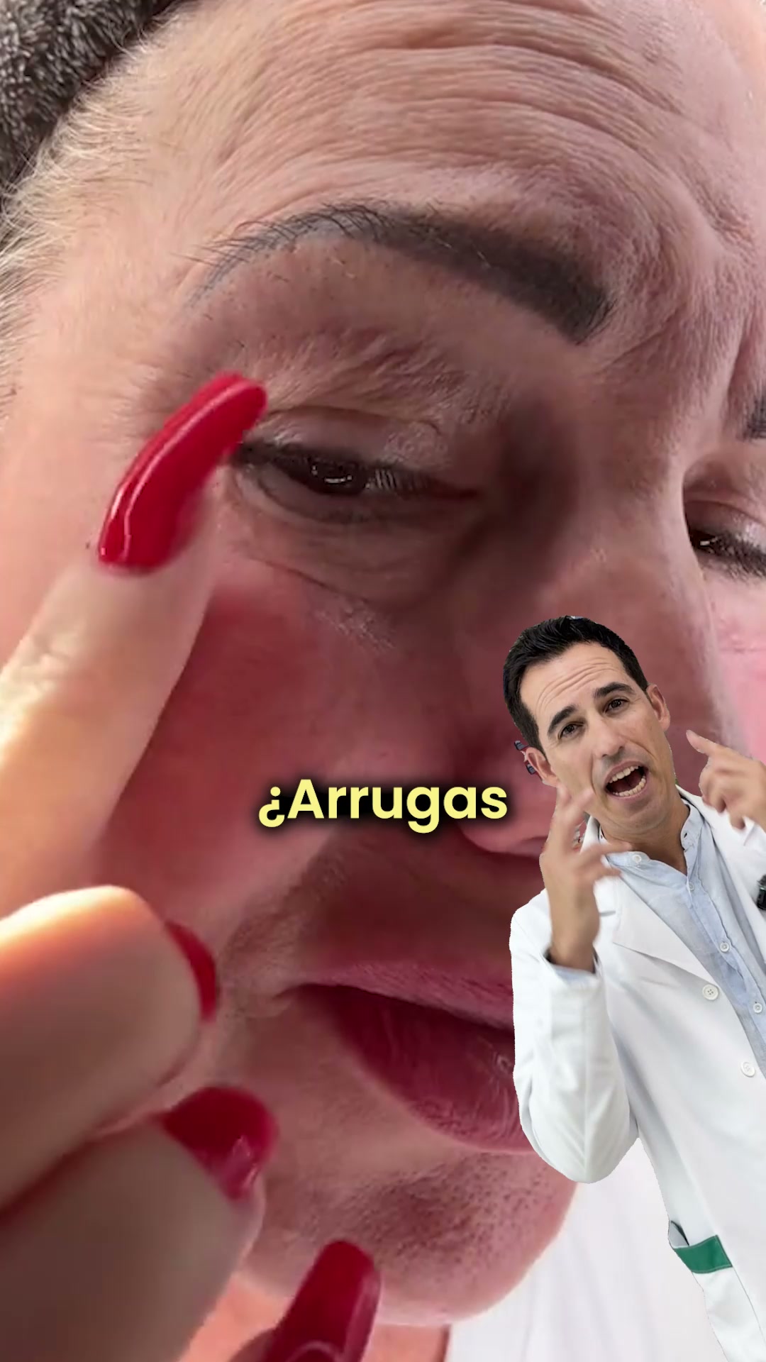 Descubre la micro-infusión Renovae