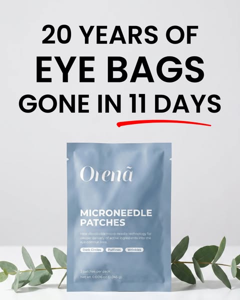 20 years of eye bags. Gone in 11 days.