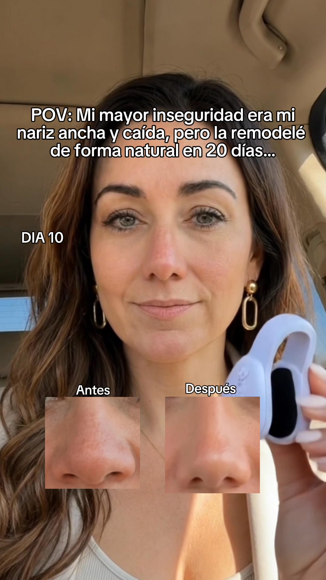50% De Descuento - ¡Últimas 17/100 Unidades!