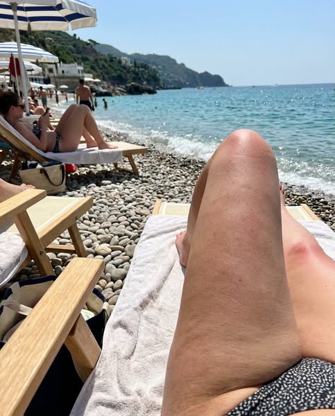 my cellulite is finally GONE