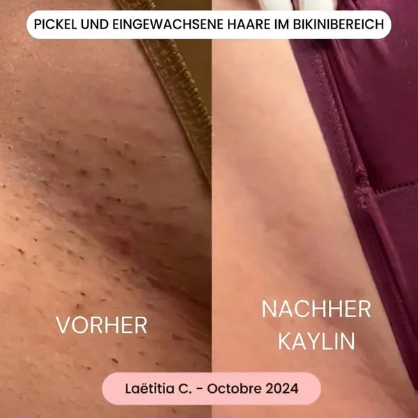 Eine hautschonende Rasur