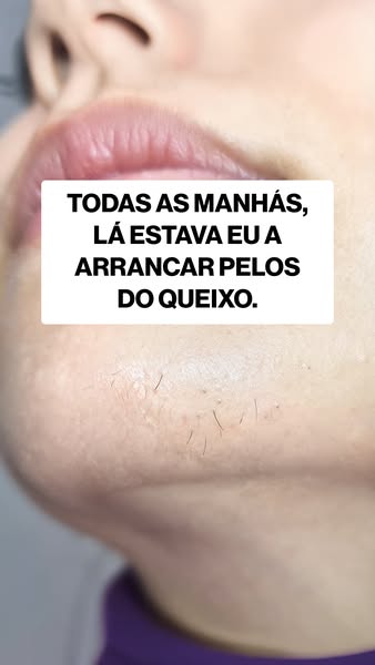 Outra vez com a pinça? A resposta pode vir de dentro.