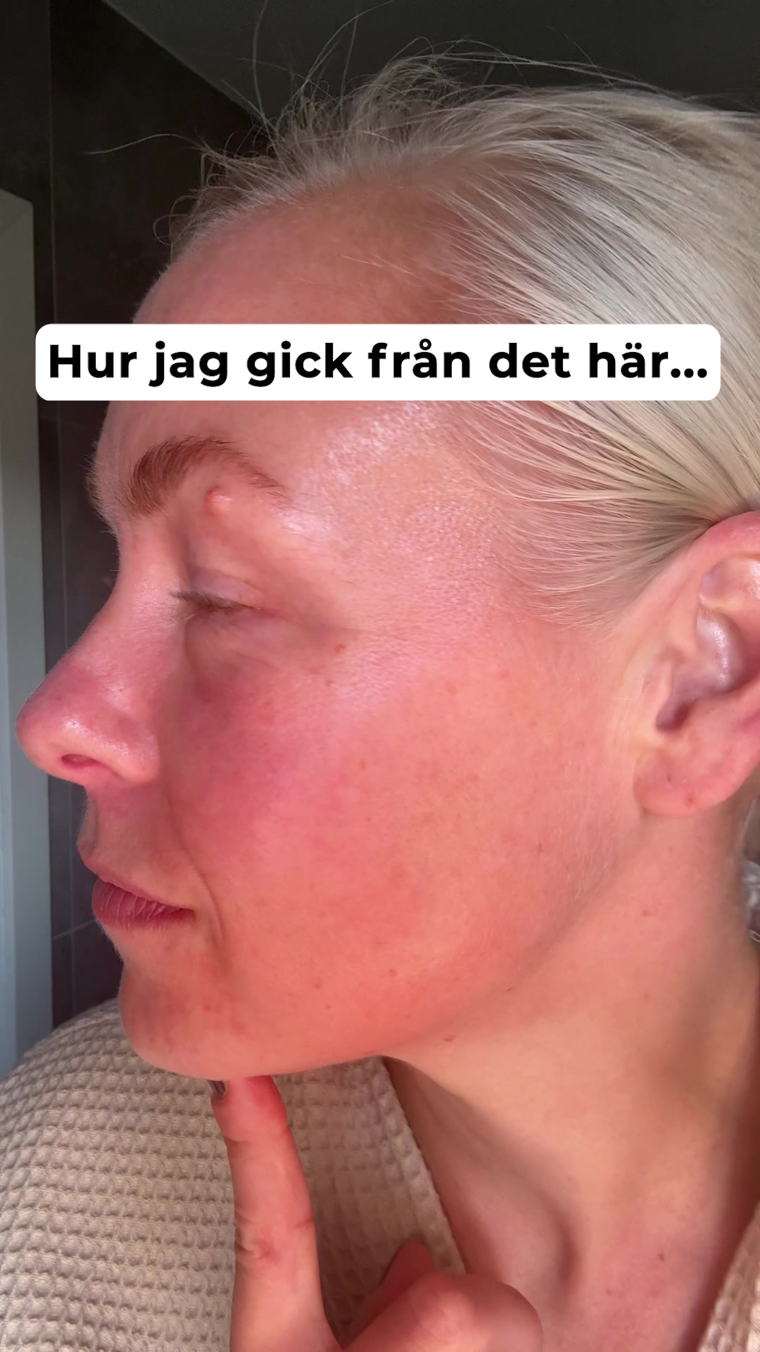 Återfå din ungdomliga skönhet