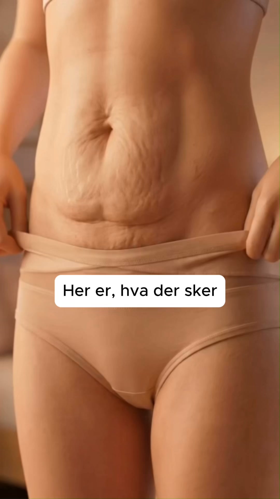 Flad mave fra første dag