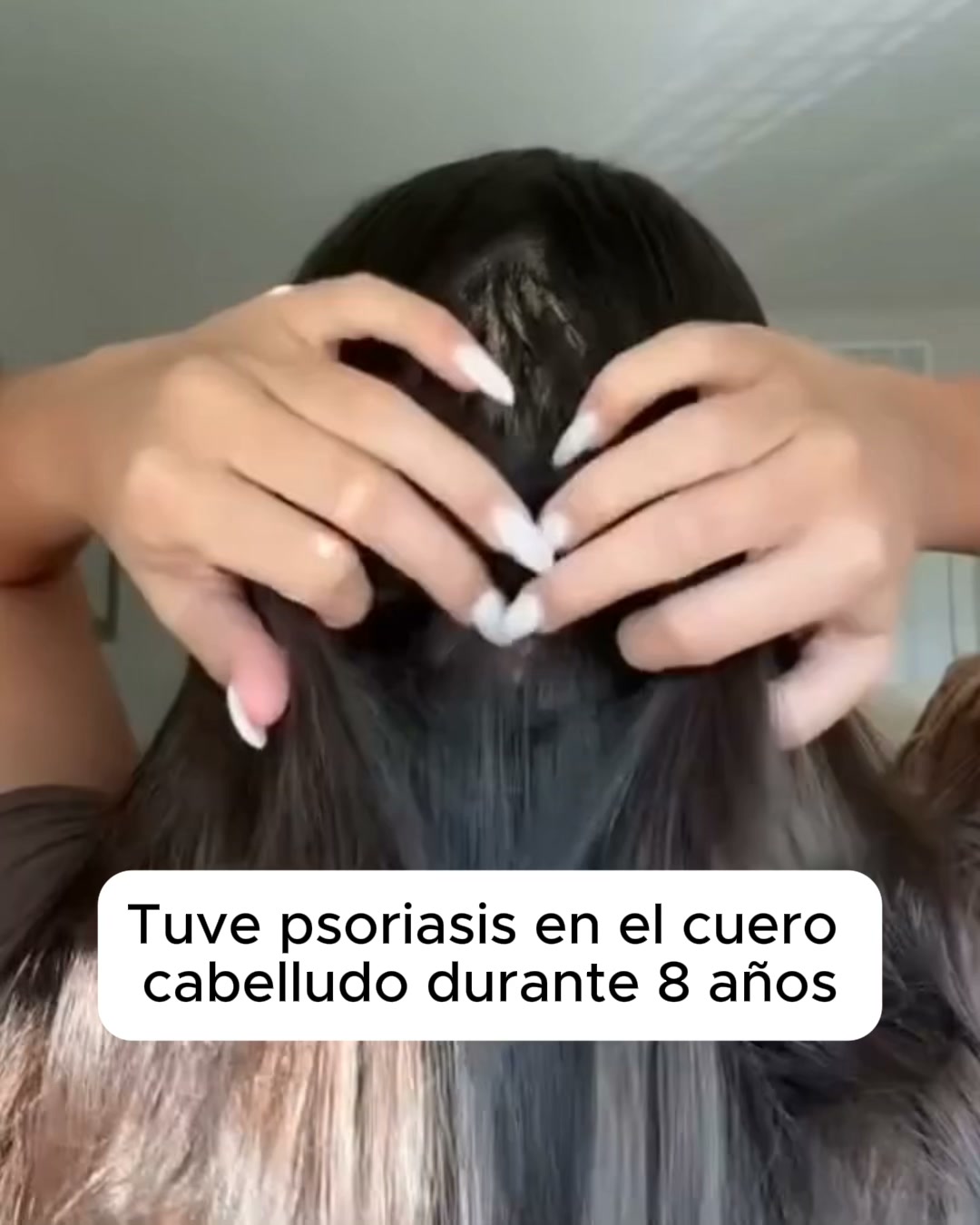 El bálsamo natural que frena el picor de raíz.