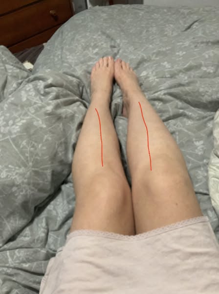i walked my hallway at 2am for 9 years