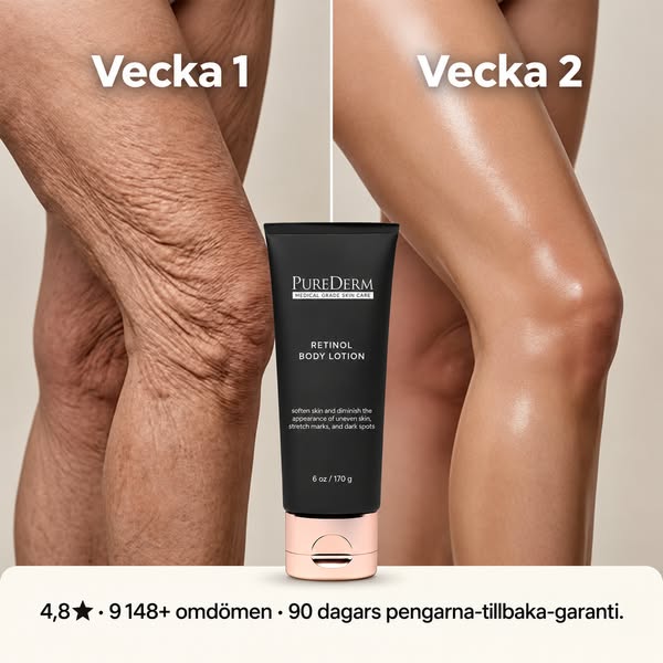 Betala senare med Klarna