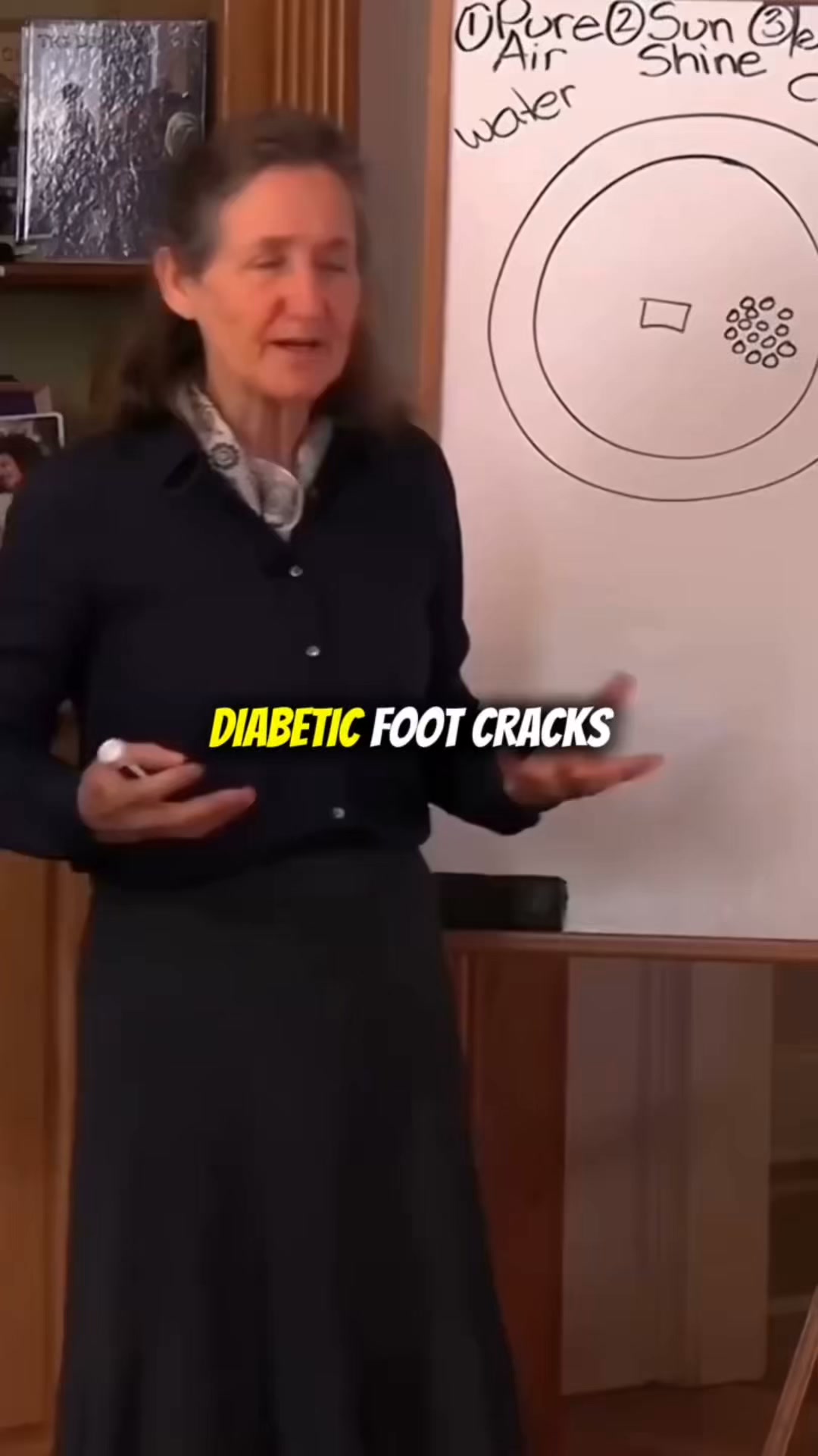 Cracked diabetic heels? Vaseline won’t touch this…