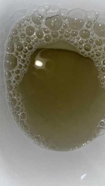 GPs are trained to treat thinning hair and bladder leaks. Not to explain the link.