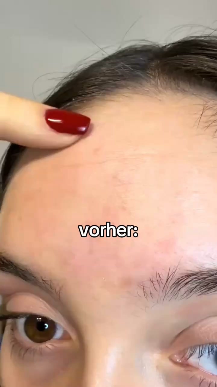 Die Kraft von Retinal