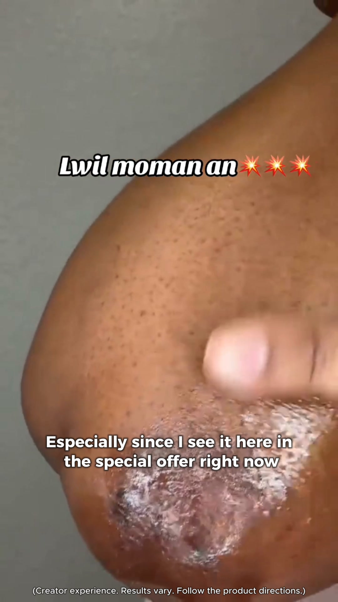 Care for High-Friction Skin
