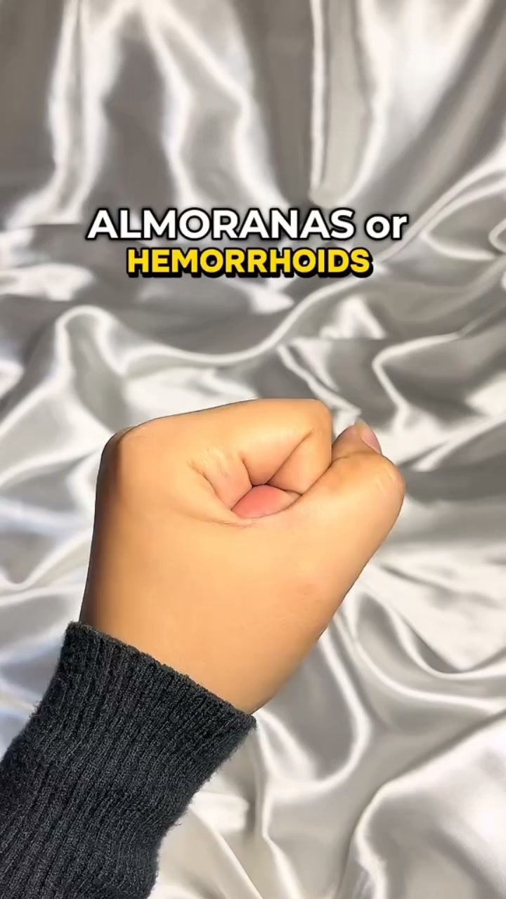 GOODBYE ALMORANAS! HEMORRHOID OINTMENT — SAVE 65%
