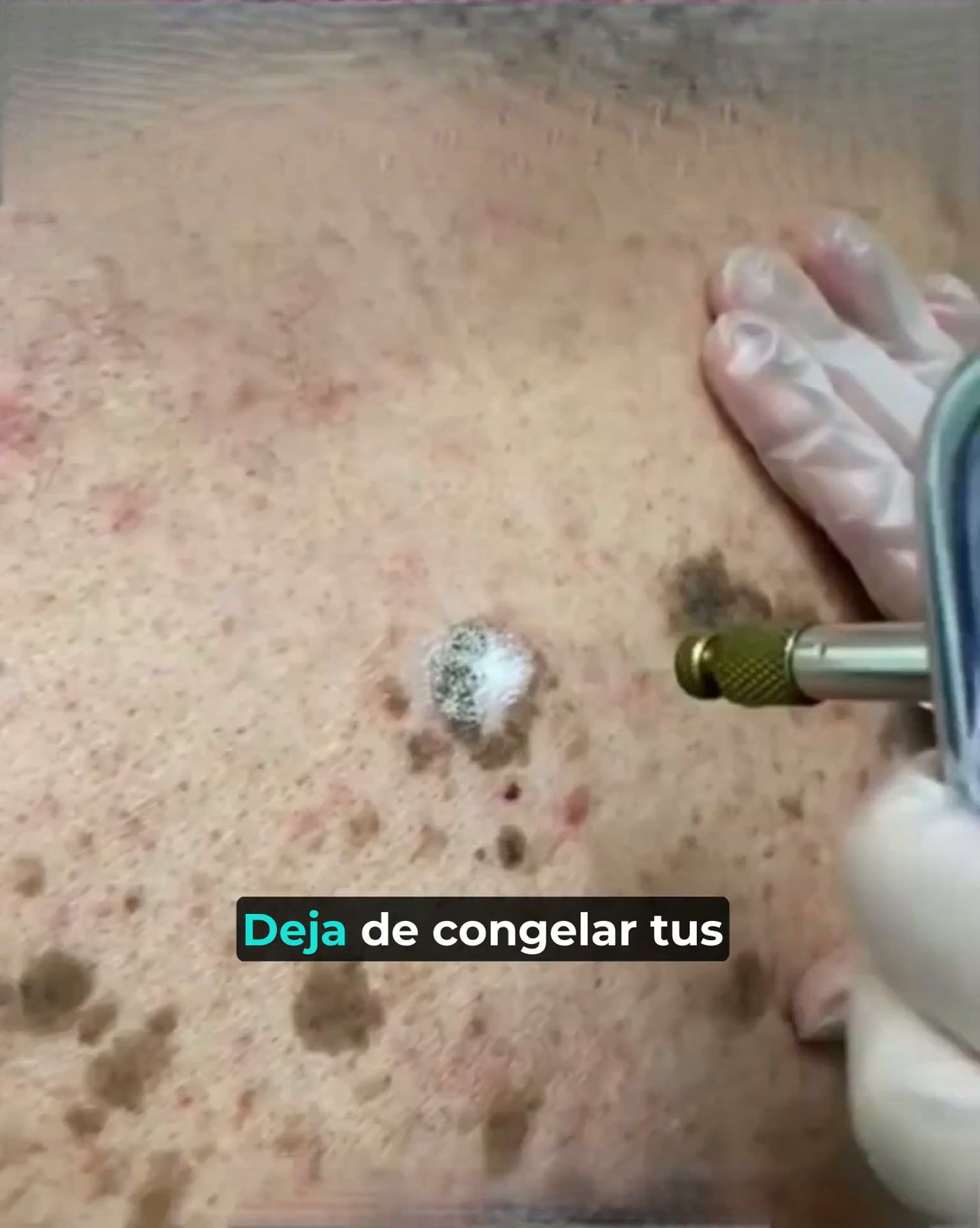 Piel suave desde la primera semana