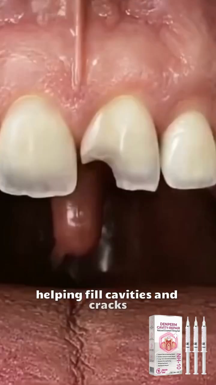 Cavity Repair FDA-Recognized 10% Nano-Hydroxyapatite (NH-10) | Delivery within 2-4 working days | Full refund guarantee