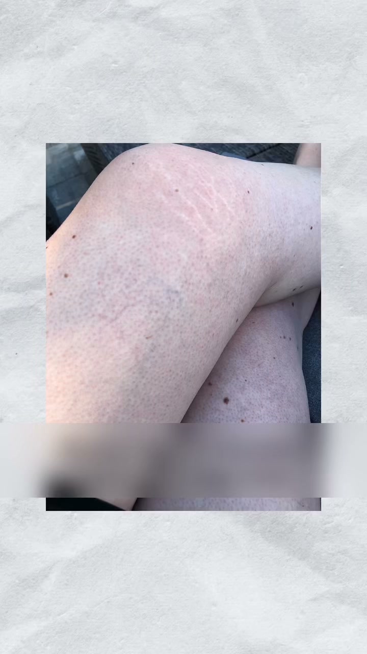 ¿Tus piernas siempre son lo más blanco?