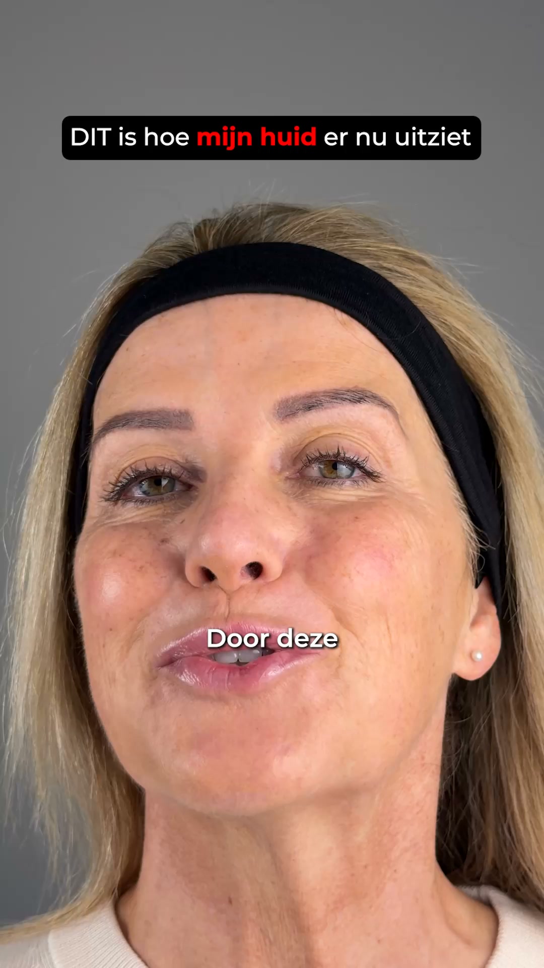 Je huid verdient meer dan hydratatie