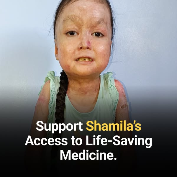 Shamila’s Skin Is Falling Off. Help Her.