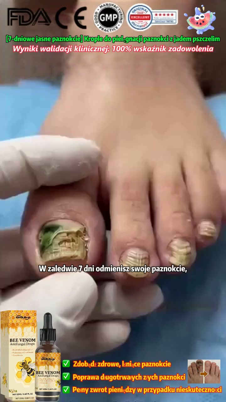 7 dni do zdrowych paznokci! Niemiecka jakość i moc jadu pszczelego.