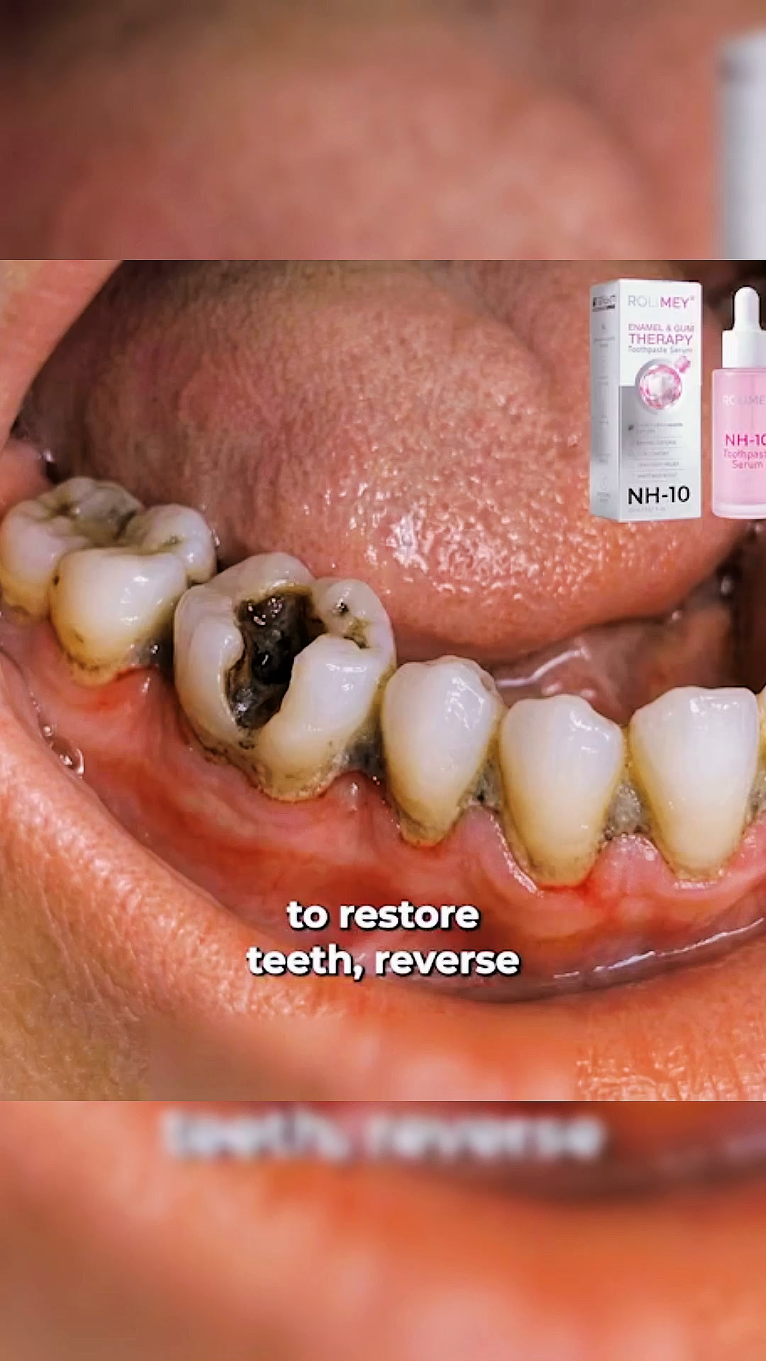 Gum repair products | √ Professional-level oral care products | Certified by the American Dental Association | Full refund guarantee