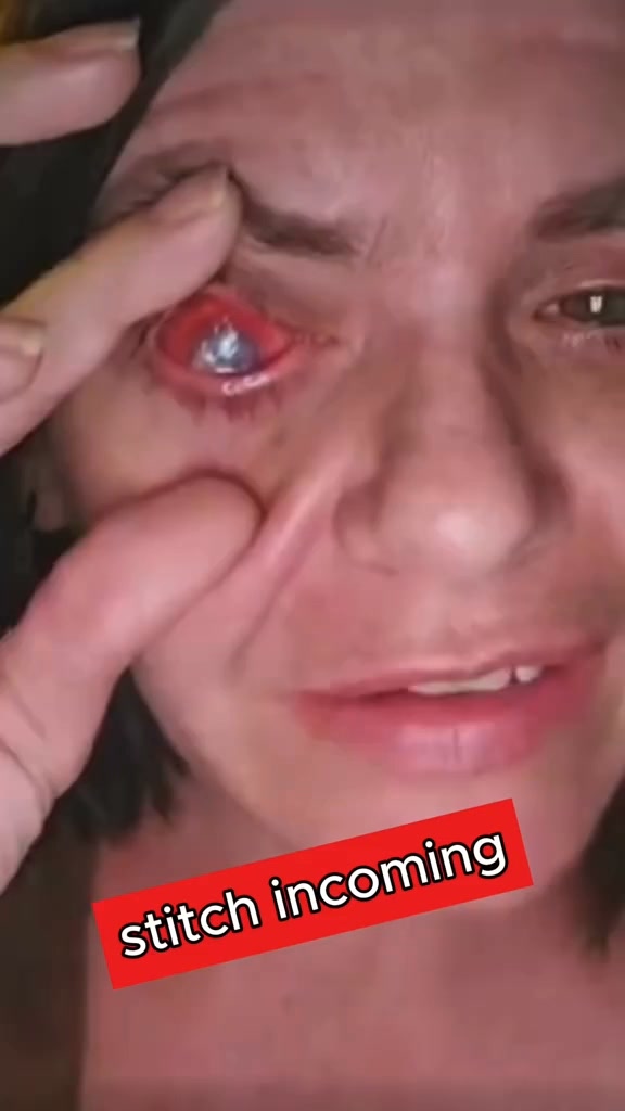 A Safer, Simpler Way to Brighter-Looking Eyes — Without the Hassle or Risks