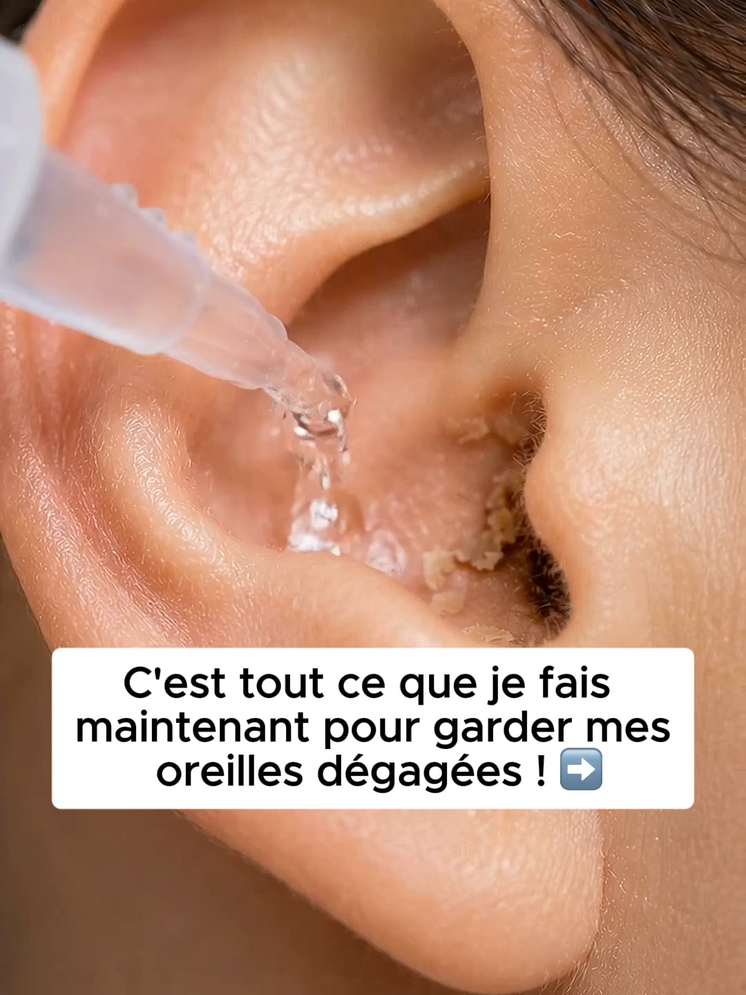 Oreilles Dégagées, Routine Simplifiée